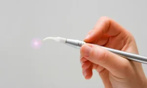 How and why Laser Dentistry Works in Wayne, PA